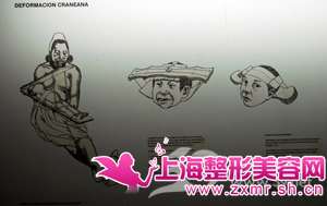 ϹҼаīϵ沿