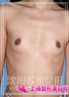 由上海整形上海整形美容网配图