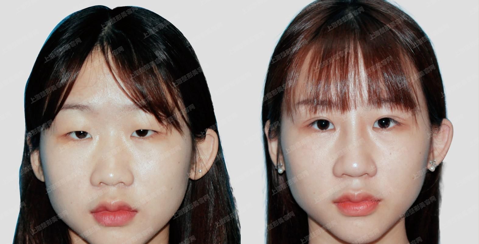 ϺļҽԺ꼪ٴ飬û