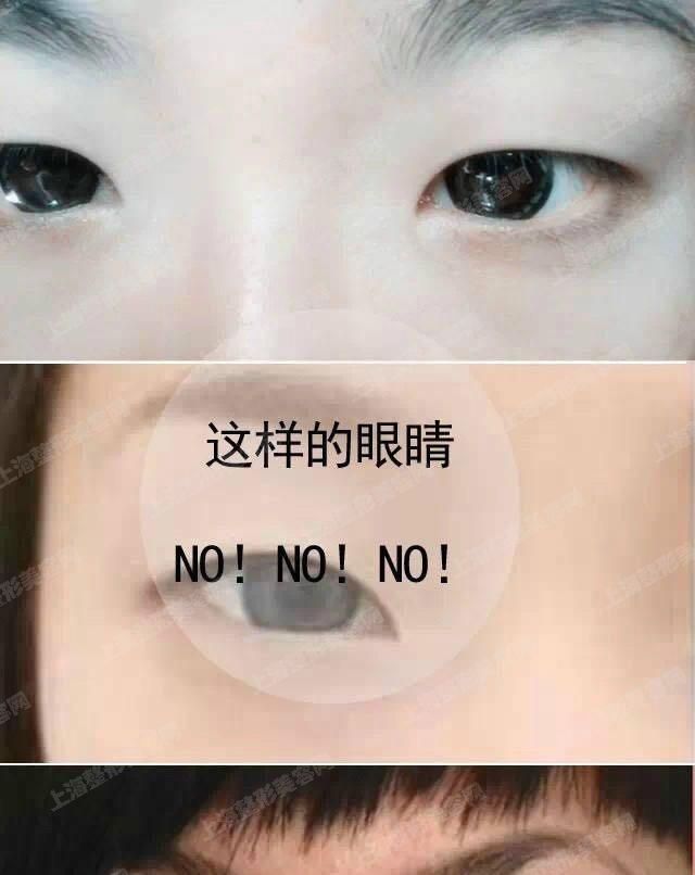 ϺҽԺ