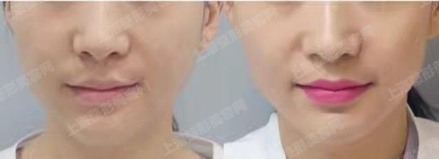 ϺļҽԺҽԺòƼϺļҽԺ
