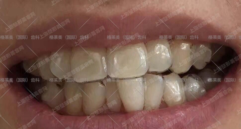 ϺҽԺѡǳҪΪһҽԺѡʦ˵ȥҽԺ