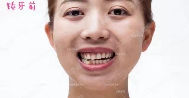 ϺҽԺǰ