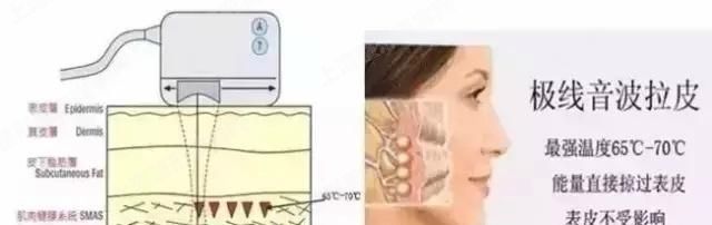 ϺһҽԺϺһҽԺ