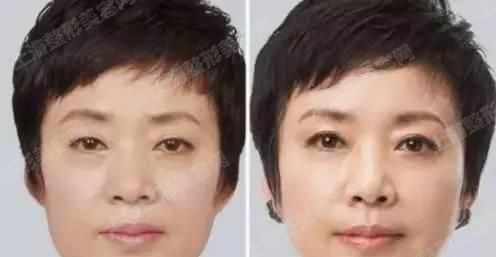 ϺҽԺһ·ʲôõҽԺҽҪǰ˽
