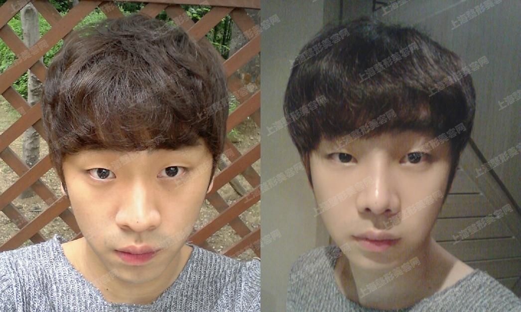 ϺҽԺyou8jin