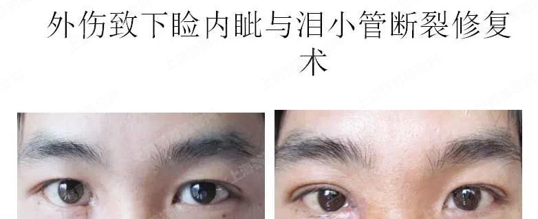上海原辰整形医院女医生张慧珍日记分享原辰医生科普知识