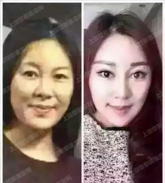 ϺҽԺԃõ֪