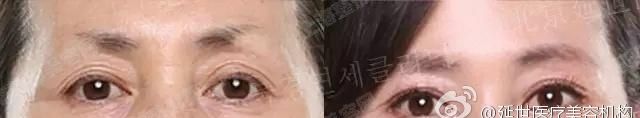 _ȥϺΣѡҽԺ