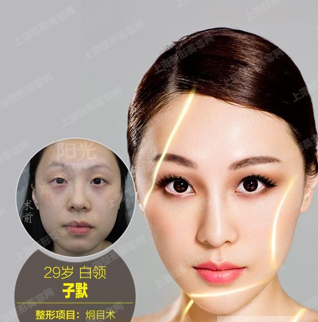 ϺҽԺļҺϺlЩҲЩܵ˵