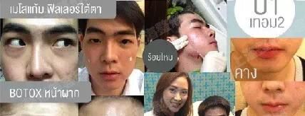 ϺҽԺûҽԺ