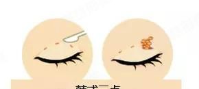 ϺҽԺҪʲôط˫ƤһЩط