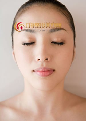 伊维兰注射除皱你年轻的保证