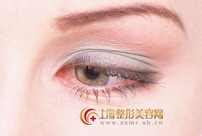 激光去眼袋,效果神奇无比