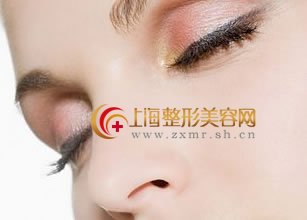 “韩式隆鼻”确实不凡