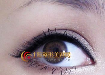 开内眼角和外眼角哪个好