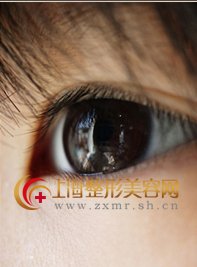 韩式媚眼术,造就迷人桃花眼