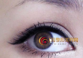 韩式双眼皮,双出迷人大媚眼