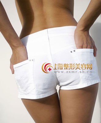 腰部吸脂完后