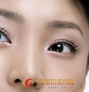 注射隆鼻,美丽鼻型即刻拥有