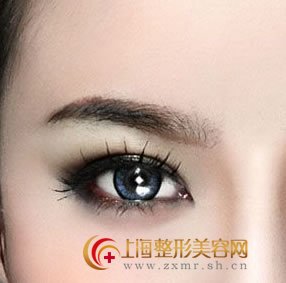 上眼睑下垂该怎么办呢