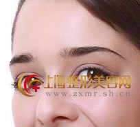 西安双眼皮哪家最便宜
