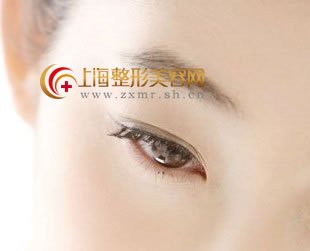 吸脂手术去除眼袋