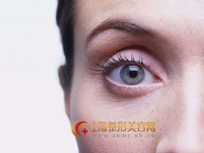 上睑下垂手术效果好吗