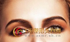 上睑下垂有哪些种类