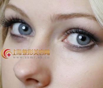 郑州祛眼袋的价格如何