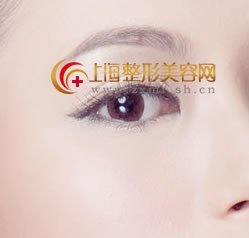 福州去眼袋费用高吗?