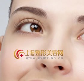 玻尿酸注射酸隆鼻到底有什么好处
