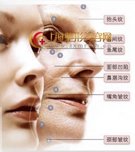 伊维兰注射除皱,我能花费吗