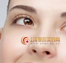 伊维兰隆鼻,造就全新美鼻
