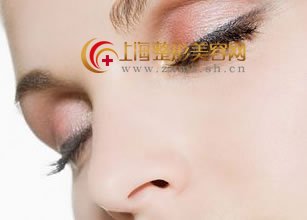 网友发现自身鼻尖不好看怎么办